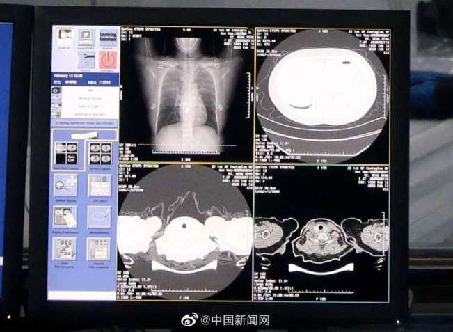 疫情当前,才知道AI原来是这么好用 疫情当前,才知道AI原来是这么好用